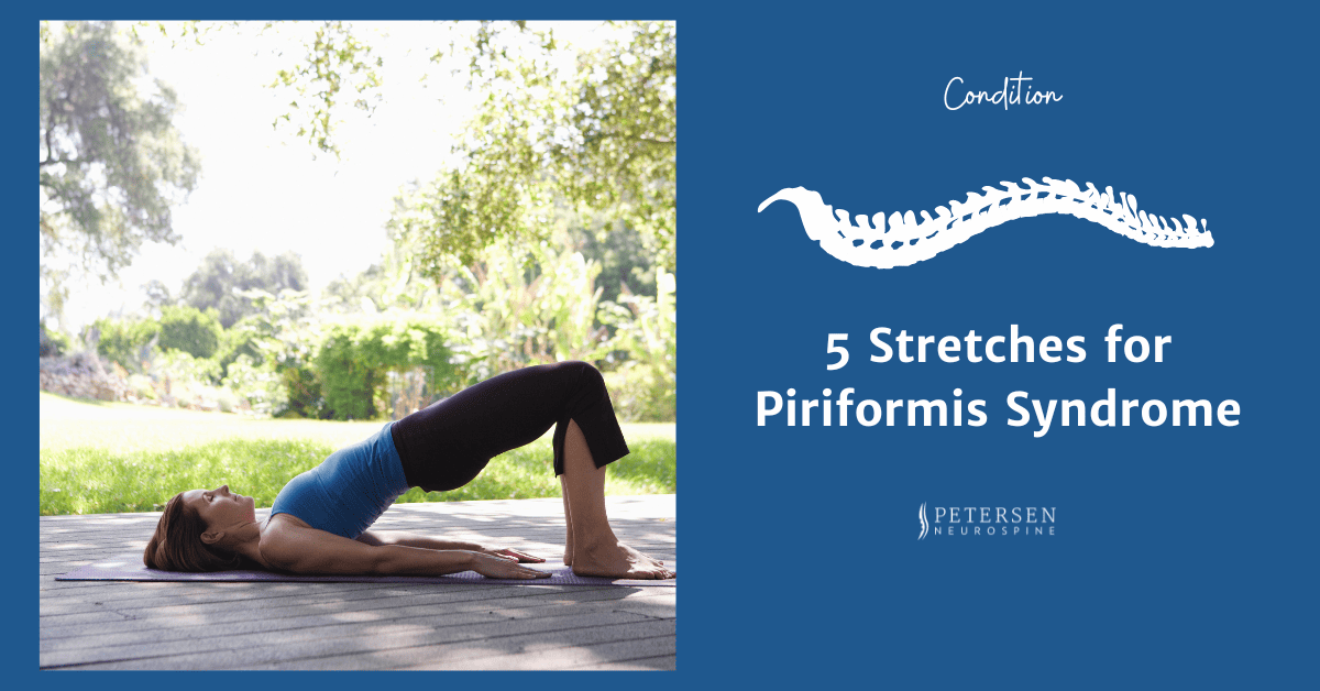 Piriformis Syndrome Exercises - YogaUOnline